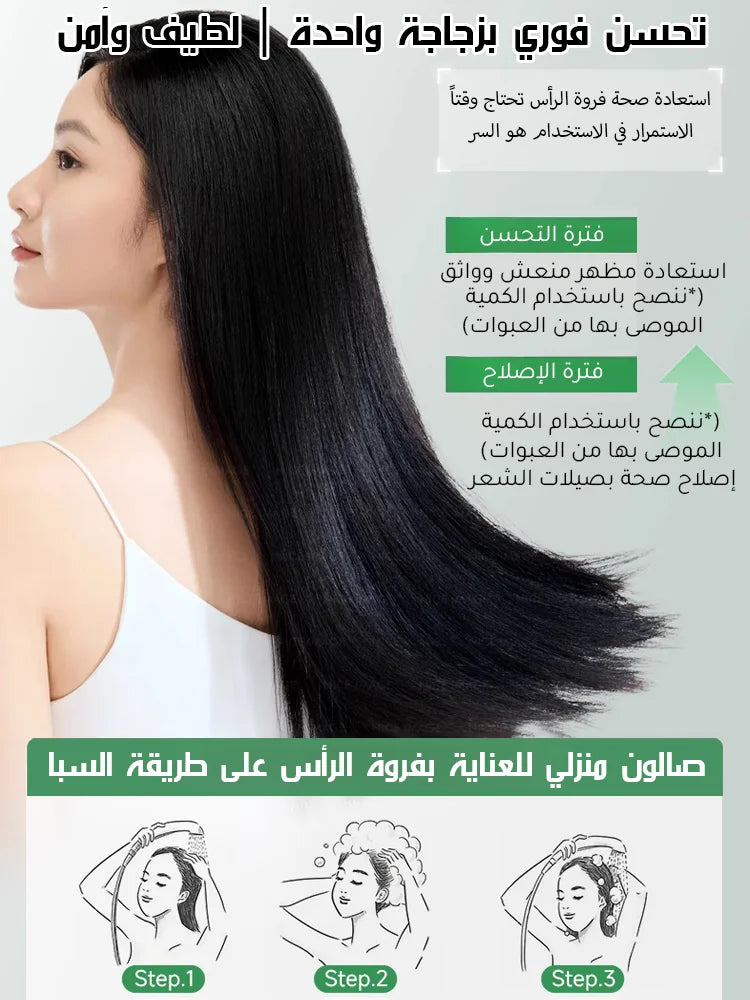 【التخلص من سعفة فروة الرأس العنيدة في 3 أسابيع】شامبو طبي مضاد للبكتيريا والعث