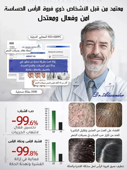 【التخلص من سعفة فروة الرأس العنيدة في 3 أسابيع】شامبو طبي مضاد للبكتيريا والعث